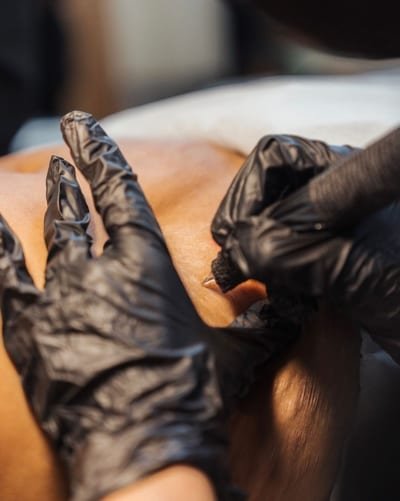 Areola restoration tattoo being applied after breast reconstruction in a private clinic setting